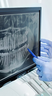 dentist pointing at digital X-rays