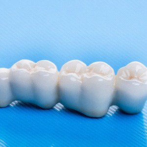 A dental bridge laying against a blue background