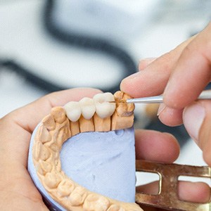 A dental bridge laying against a blue background