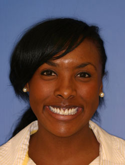 Dental patient smiling with imperfect teeth