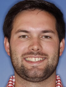 Smiling man with gap between two front teeth