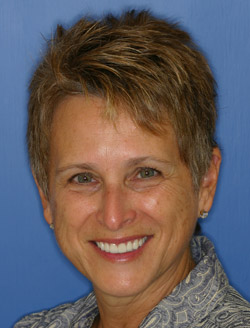 Woman smiling after a dental visit with intraoral cameras in North Dallas