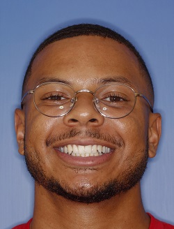 Dental patient smiling with imperfect teeth