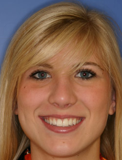 Woman smiling after receiving dental services in North Dallas