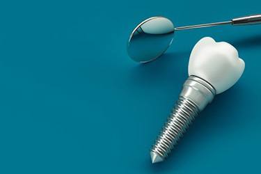 Close up of a dental implant on a blue background