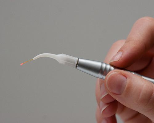 a person holding a dental laser tool