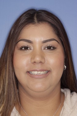 Dental patient smiling with imperfect teeth