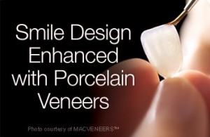 porcelain-veneers-350