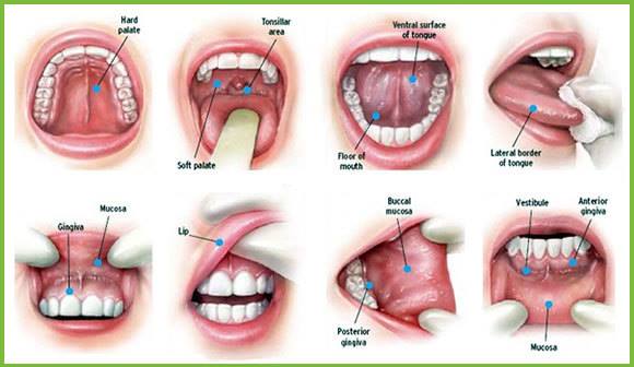 Pictures of the mouth and different areas to look for oral cancer.