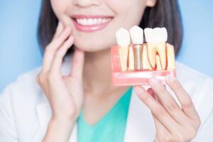 Dentist smiling and touching her jaw in the background while holding a model dental implant to the foreground