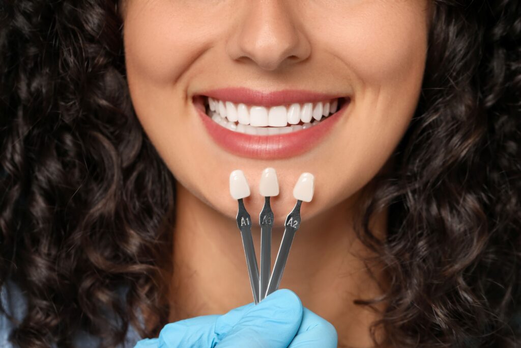 Nose-to-neck view of woman with dark curly hair smiling with shade guide held to teeth
